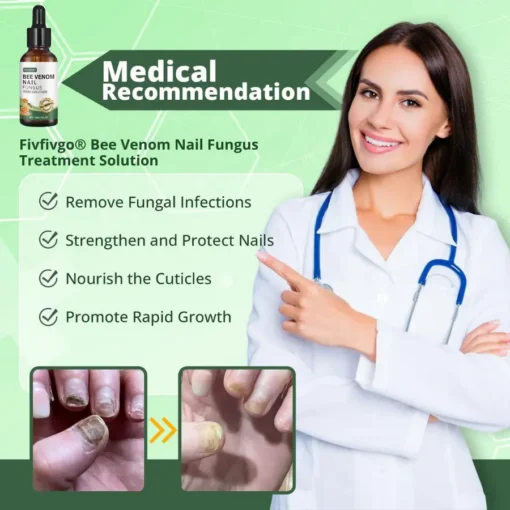 Fivfivgo® Bee Venom Nail Fungus Treatment Solution