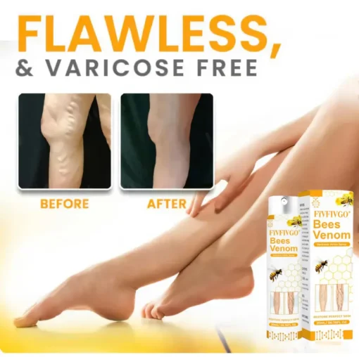 Fivfivgo® Bees Venom Varicose Veins Spray