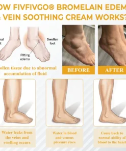 Fivfivgo® Bromelain Edema & Vein Soothing Cream