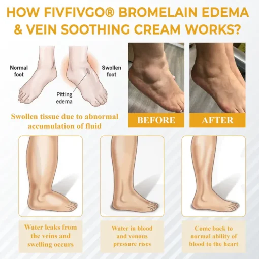 Fivfivgo® Bromelain Edema & Vein Soothing Cream