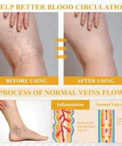 Fivfivgo® Bromelain Edema & Vein Soothing Cream