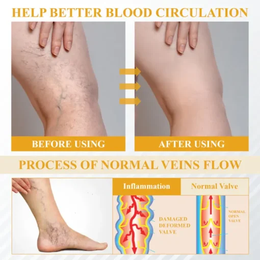 Fivfivgo® Bromelain Edema & Vein Soothing Cream