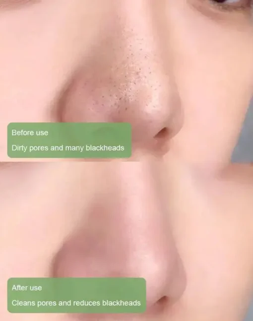 Fivfivgo™ Green Tea Detox Purifying Mask