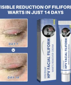 Fivfivgo® HPV Facial Filiform Warts Removal Cream