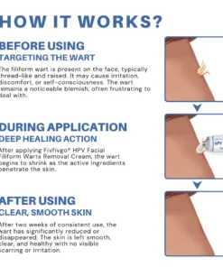 Fivfivgo® HPV Facial Filiform Warts Removal Cream