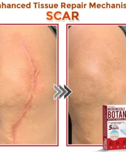 Fivfivgo® MicroNeedle Botanic Skin Tag Removal Patch