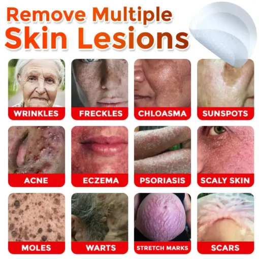 Fivfivgo® MicroNeedle Botanic Skin Tag Removal Patch