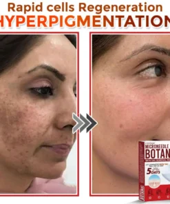 Fivfivgo® MicroNeedle Botanic Skin Tag Removal Patch