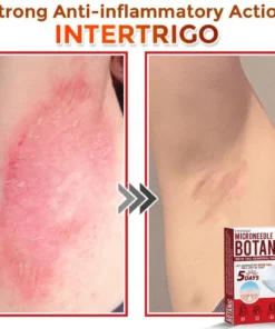 Fivfivgo® MicroNeedle Botanic Skin Tag Removal Patch