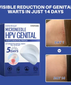 Fivfivgo® Microneedle HPV Genital Warts Removal Patch