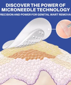 Fivfivgo® Microneedle HPV Genital Warts Removal Patch