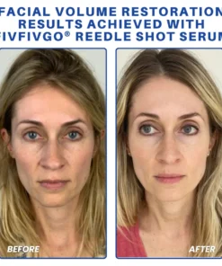 Fivfivgo® PDRN-NAD+ Cica Reedle Shot Serum