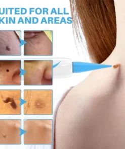 Fivfivgo® Painless At-home Skin Tag Removal Pen
