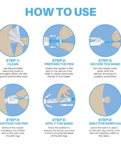 Fivfivgo® Painless At-home Skin Tag Removal Pen