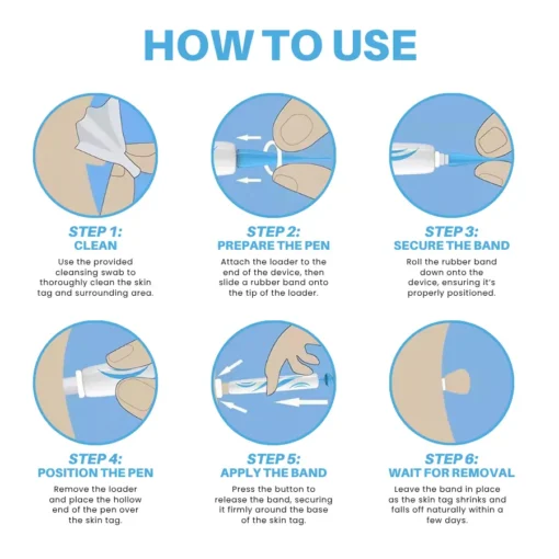 Fivfivgo® Painless At-home Skin Tag Removal Pen