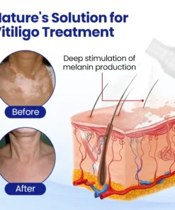 Fivfivgo® VitiClear Herbal Spray