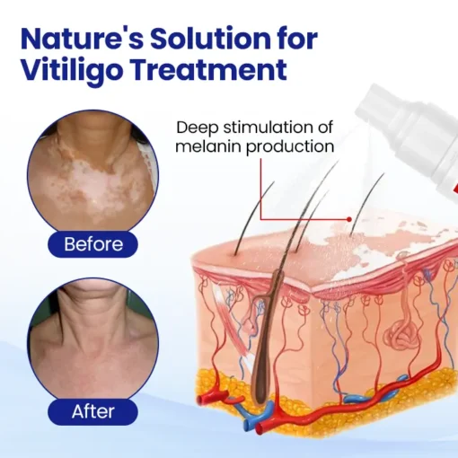 Fivfivgo® VitiClear Herbal Spray