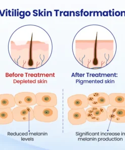 Fivfivgo® VitiClear Herbal Spray