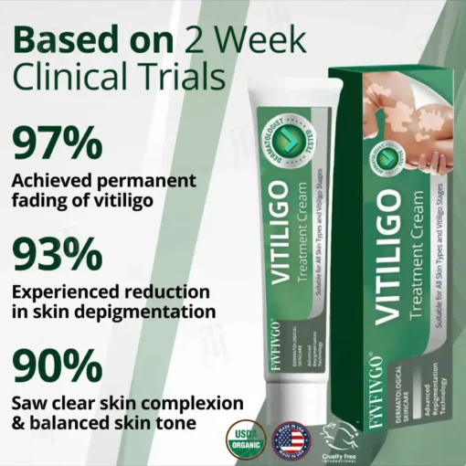 Fivfivgo® Vitiligo Treatment Cream