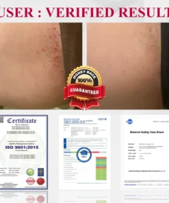 Fivfivgo® Woman's Genital HPV Healing Cream