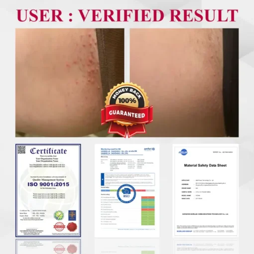 Fivfivgo® Woman's Genital HPV Healing Cream