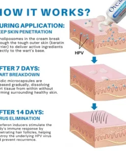 Fivfivgo® HPV Genital Warts ULTRA Relief Cream