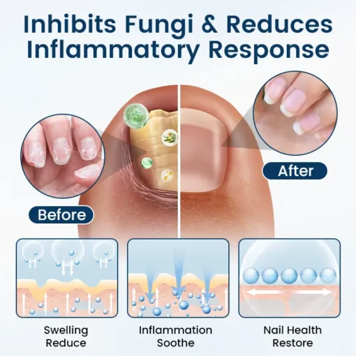 Fivfivgo® OnyxiGuard Fungal Repair Herbal Spray