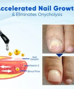 Fivfivgo® OnyxoGuard Nail Growth and Repair Serum