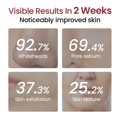 Fivfivgo® Peel Shot Glow Black Rice Ampoule