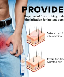 Fivfivgo® Scrotum Itchy Treatment Cream
