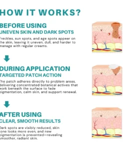 Fivfivgo® Botanical Freckles & Spot Removal Patch
