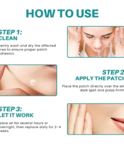 Fivfivgo® Botanical Freckles & Spot Removal Patch