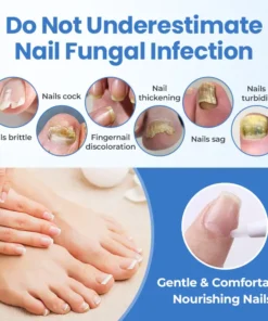 Fivfivgo® MycoErase Nail Revive Pen