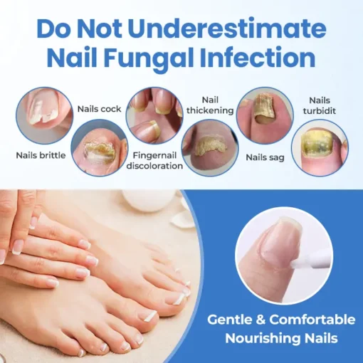 Fivfivgo® MycoErase Nail Revive Pen
