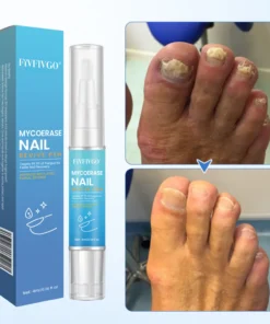 Fivfivgo® MycoErase Nail Revive Pen