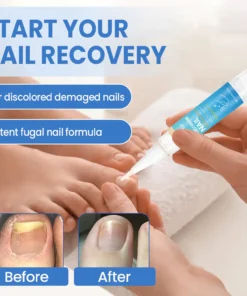 Fivfivgo® MycoErase Nail Revive Pen