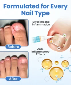 Fivfivgo® MycoErase Nail Revive Pen