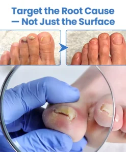 Fivfivgo® MycoErase Nail Revive Pen