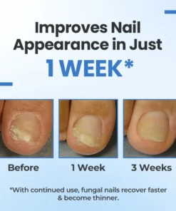 Fivfivgo® MycoErase Nail Revive Pen