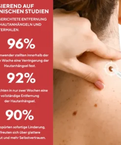 Fivfivgo® Stift zum Entfernen von Hautflecken und Leberflecken