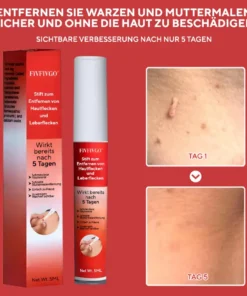 Fivfivgo® Stift zum Entfernen von Hautflecken und Leberflecken