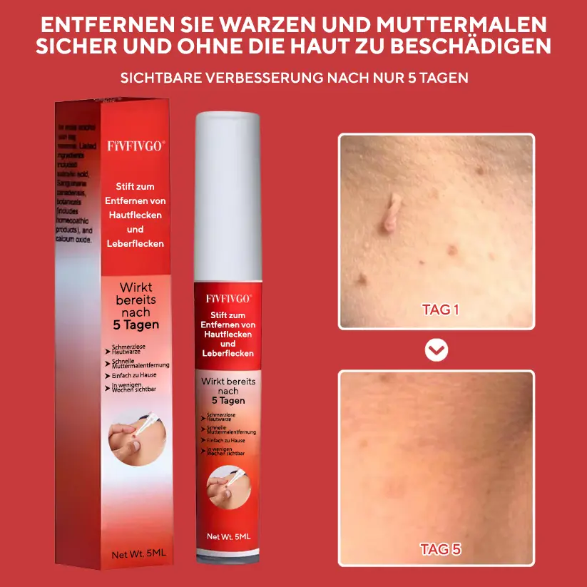 Fivfivgo® Stift zum Entfernen von Hautflecken und Leberflecken