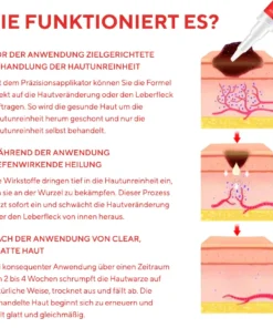 Fivfivgo® Stift zum Entfernen von Hautflecken und Leberflecken