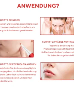 Fivfivgo® Stift zum Entfernen von Hautflecken und Leberflecken