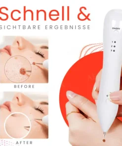 Fivfivgo™ Tragbarer Hautpflege-Laserstift