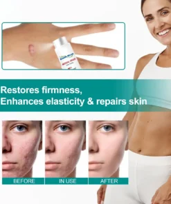 Fivfivgo™ Advanced Scar Removal Spray