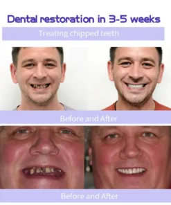 Fivfivgo® Teeth Restoration Mineral Powder
