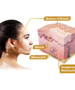 VitiGO™ Bee Venom Corrector Cream