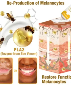 VitiGO™ Bee Venom Corrector Cream