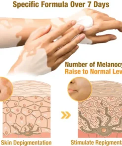 VitiGO™ Bee Venom Corrector Cream